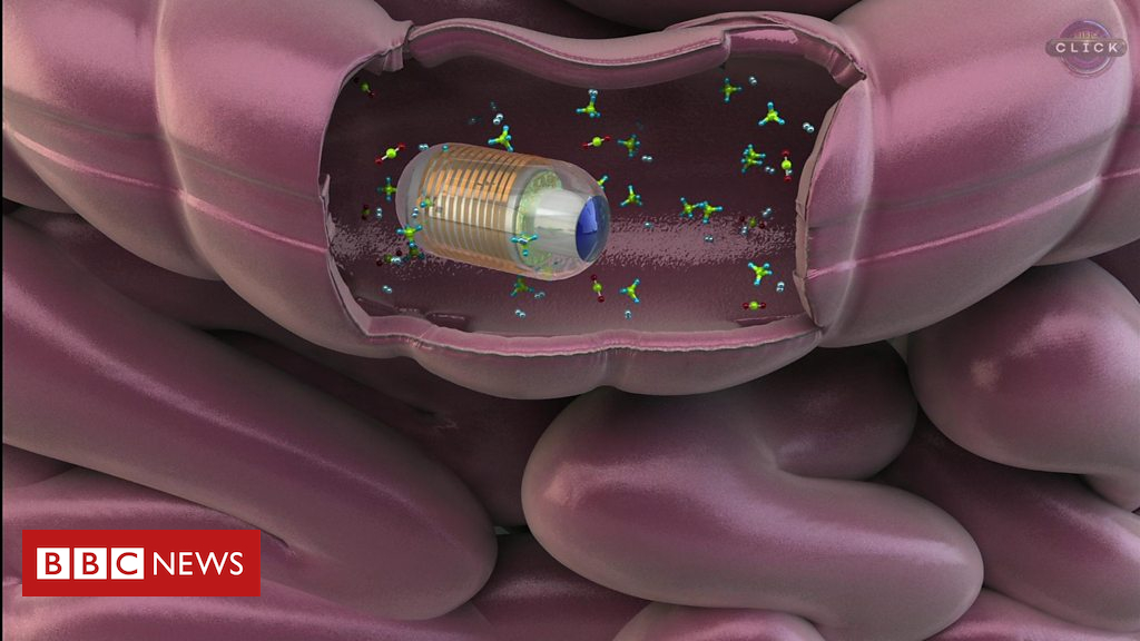 Gas detecting pill could diagnose poor gut health