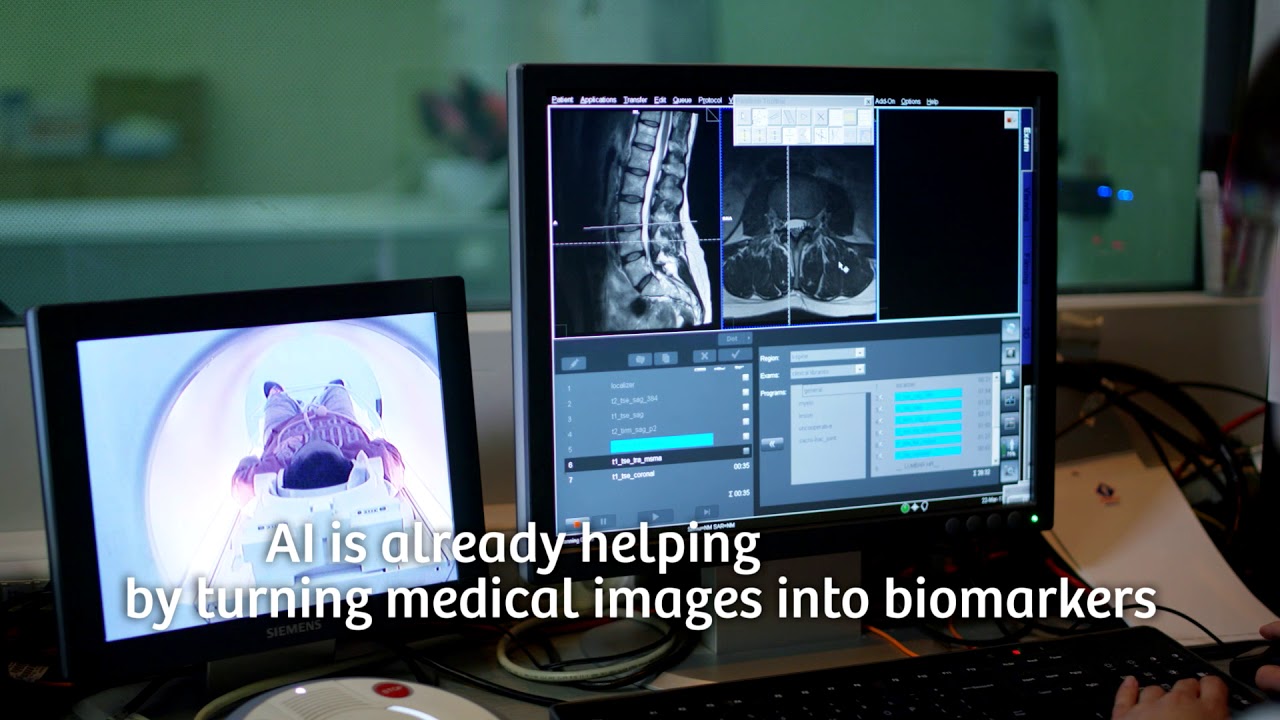 AI & Radiology – Medical Imaging in the age of Artificial Intelligence