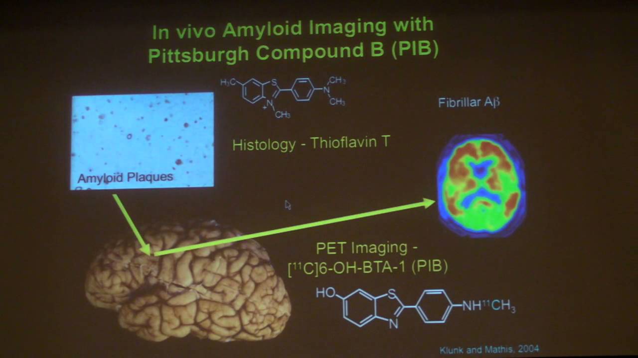 California Cognitive Science Conference 2013: William Jagust