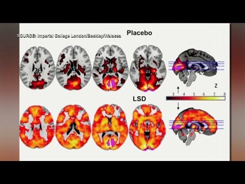 LSD study shows evidence of higher level of consciousness