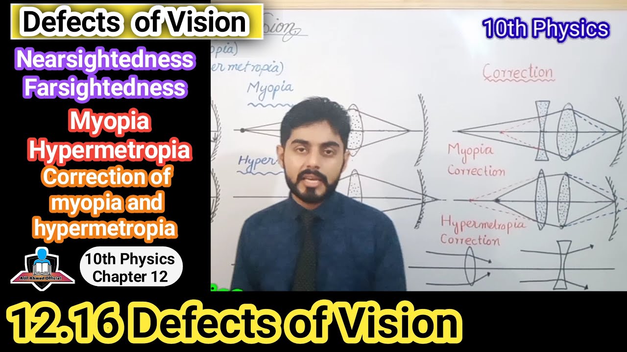 Defects of Vision 10th physics | nearsightedness | myopia | hypermetropia | correction of defects