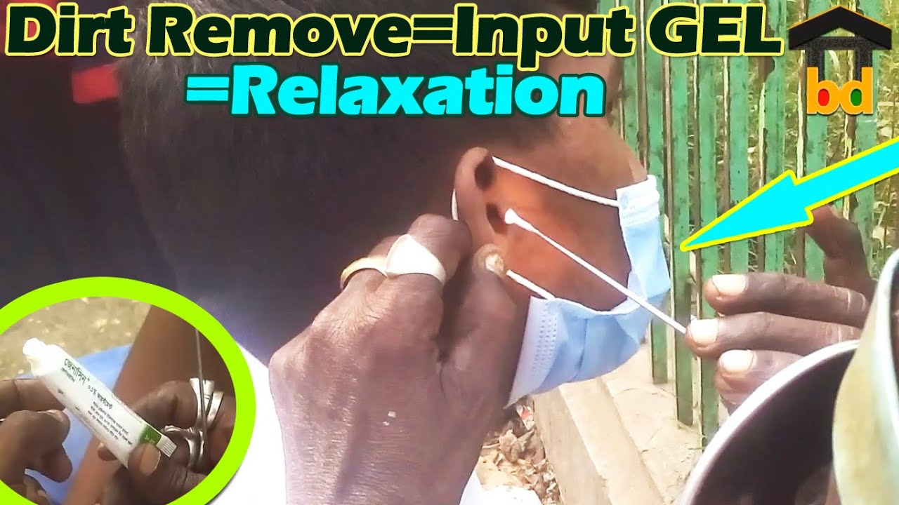 ►Conscious Guy Get Refreshed by Little Costing Only 20 Taka II Cheap Rated Ear Waxing with Input GEL
