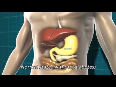 Diabetes and the body | Diabetes UK