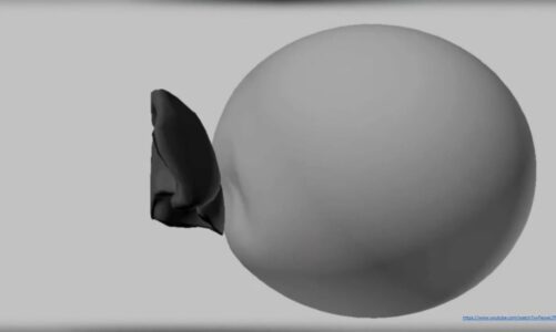 Pleural Line/Ultrasound Semiotics