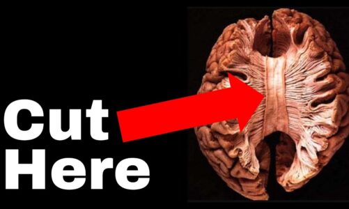 The Unsettling Truth about Human Consciousness | The Split Brain experiment that broke neuroscience